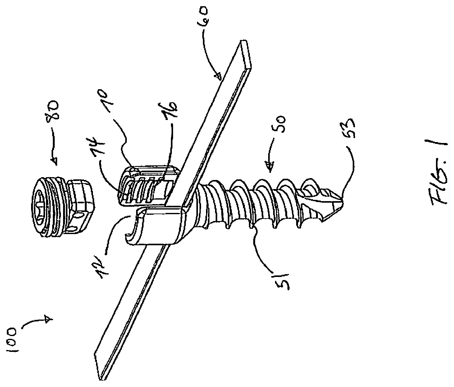 Patent US12376887 — Tethering screw system — Figure 1