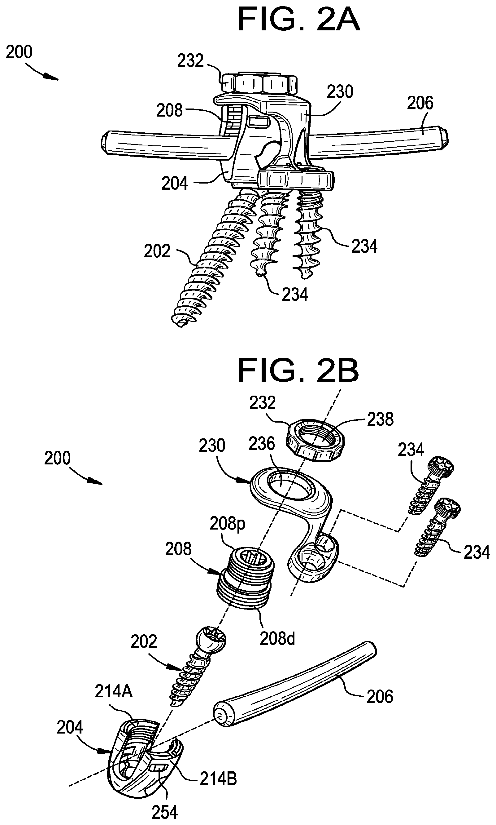 Patent US12376888 Figure 2 – Multipoint fixation implants