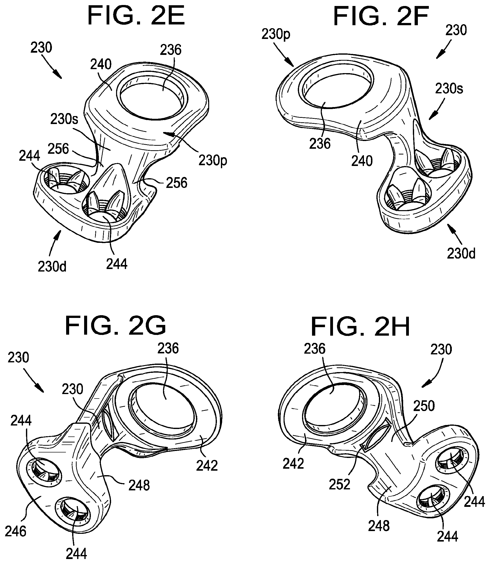Patent US12376888 Figure 4 – Multipoint fixation implants