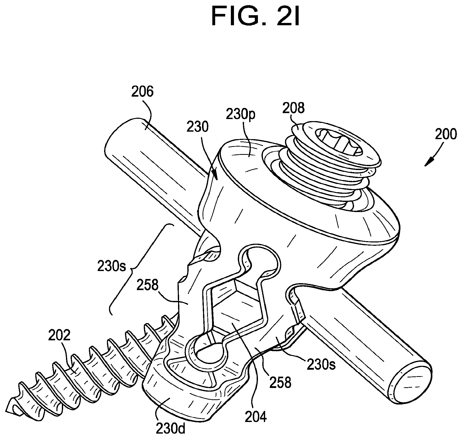 Patent US12376888 Figure 5 – Multipoint fixation implants