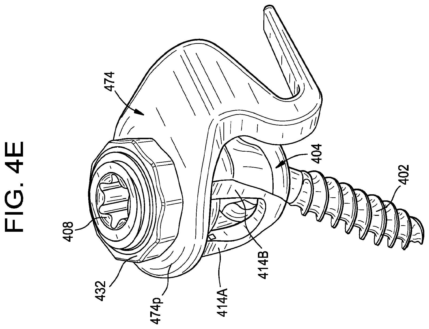 Patent US12376888 Figure 13 – Multipoint fixation implants