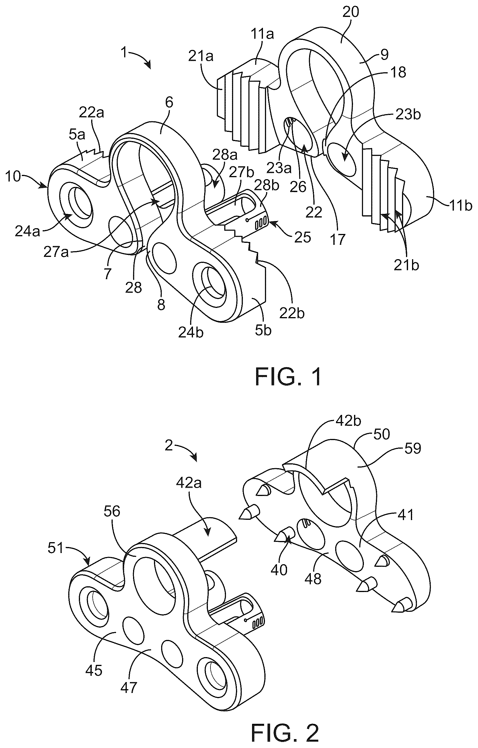 Patent US12376890 — Dynamic and non-dynamic interspinous fusion implant and bone growth stimulation system — Figure 1