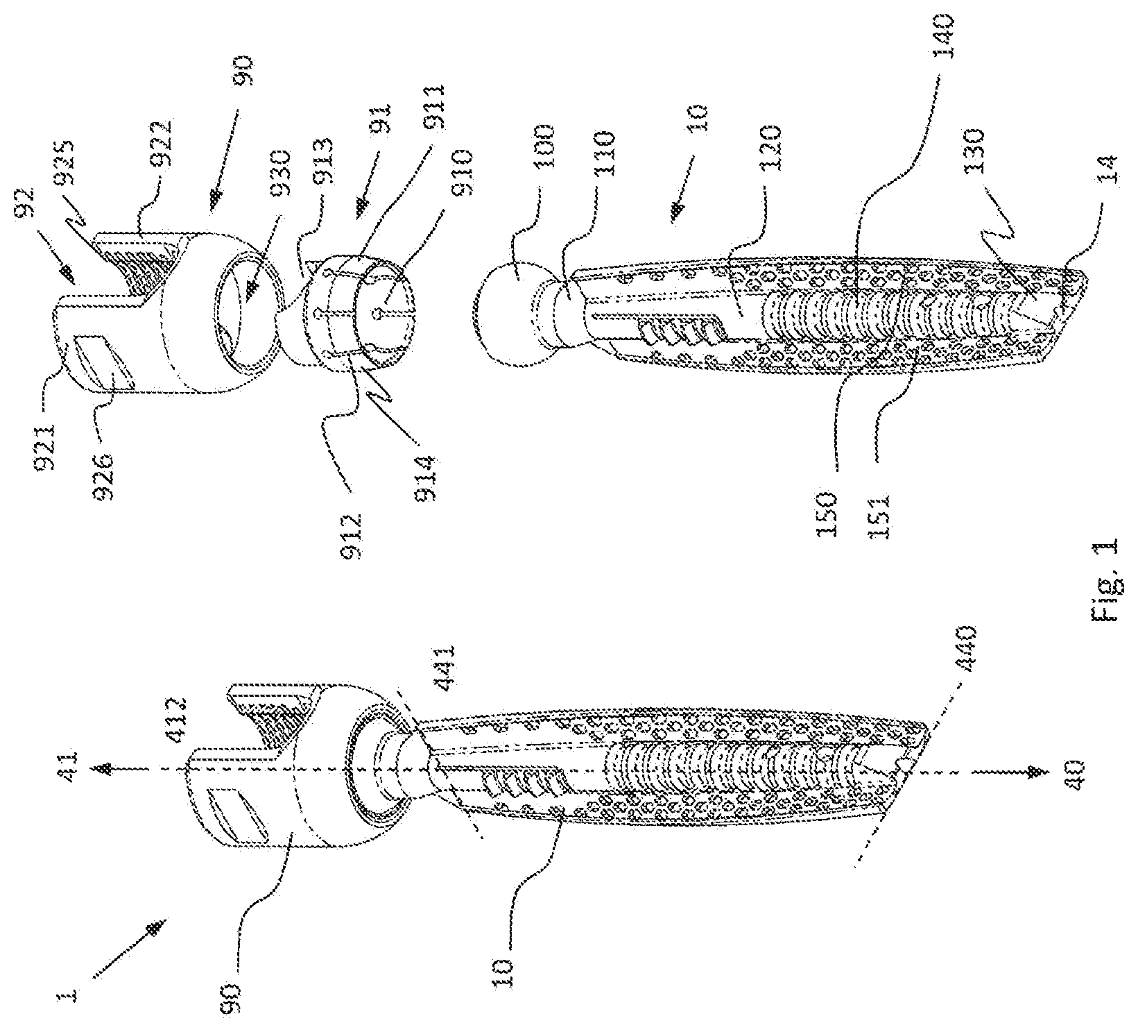 Patent US12376892 — Bone-anchoring device for a pedicle access — Figure 1