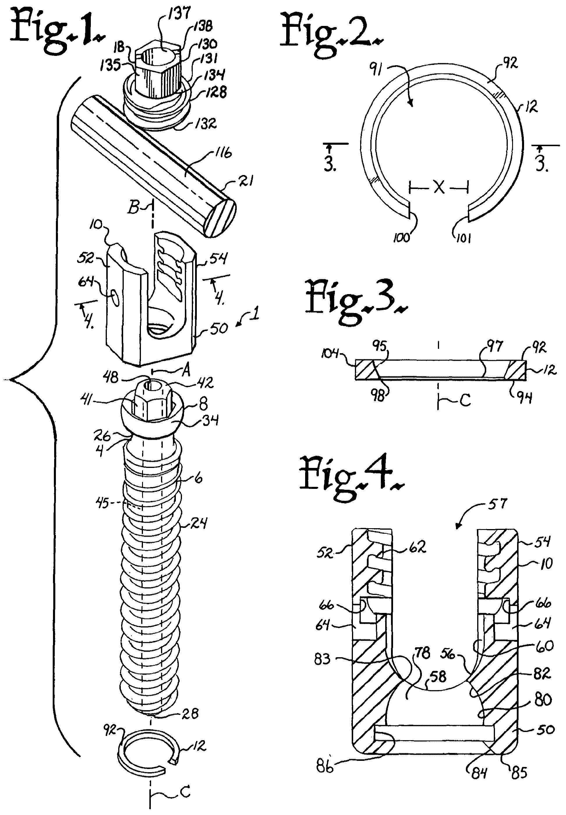 Patent US12376894 — Pivotal bone anchor assembly with ring retainer and twist-in-place pressure insert — Figure 1
