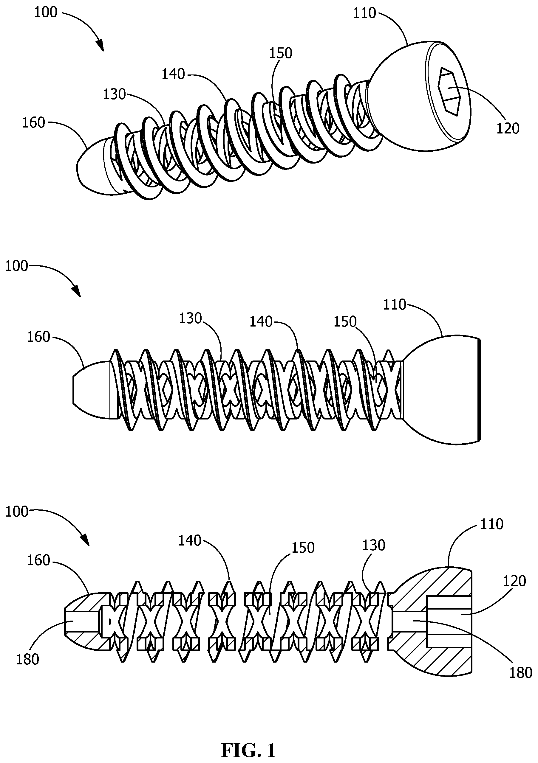 Patent US12376895 — Implants for tissue fixation and fusion — Figure 1