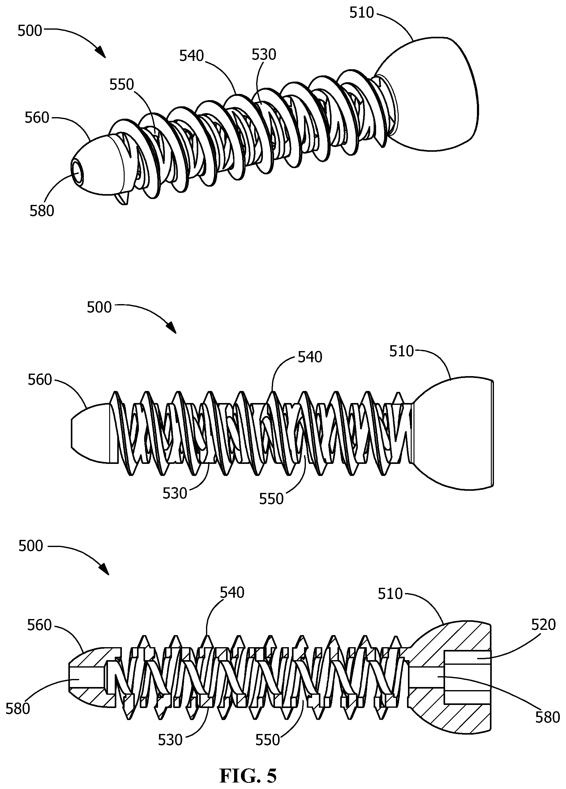 Patent US12376895 Figure 5 – Implants for tissue fixation and fusion