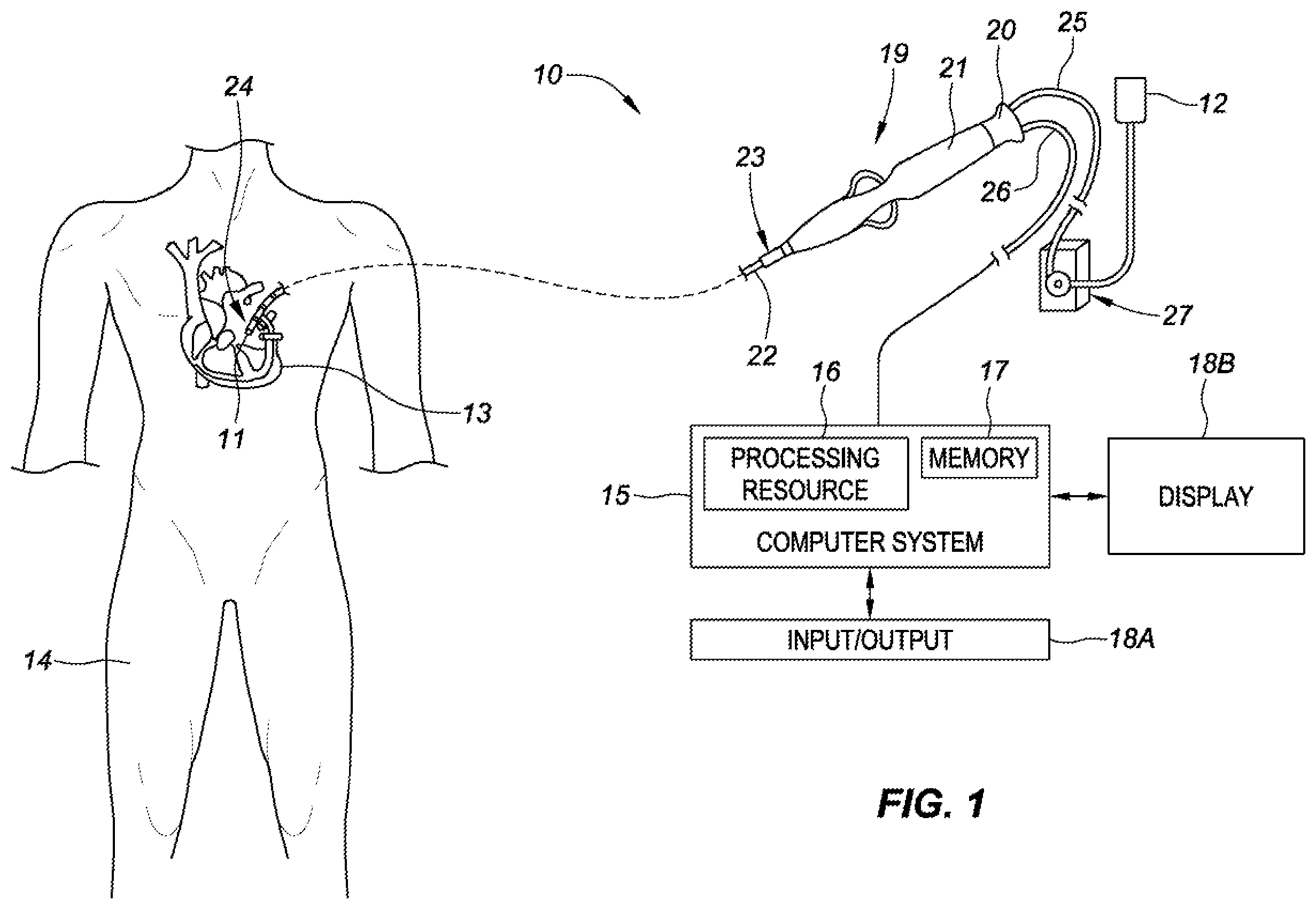 Patent US12376901 — Radio-frequency ablation and direct current electroporation catheters — Figure 1