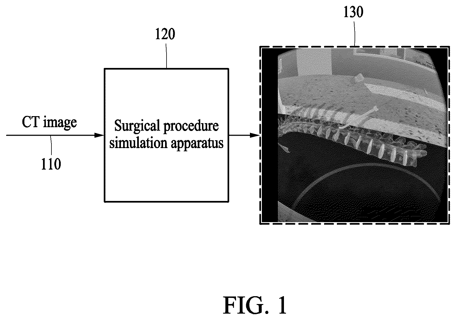 Patent US12376906 — Method and apparatus for surgical procedure simulation based on virtual reality — Figure 1