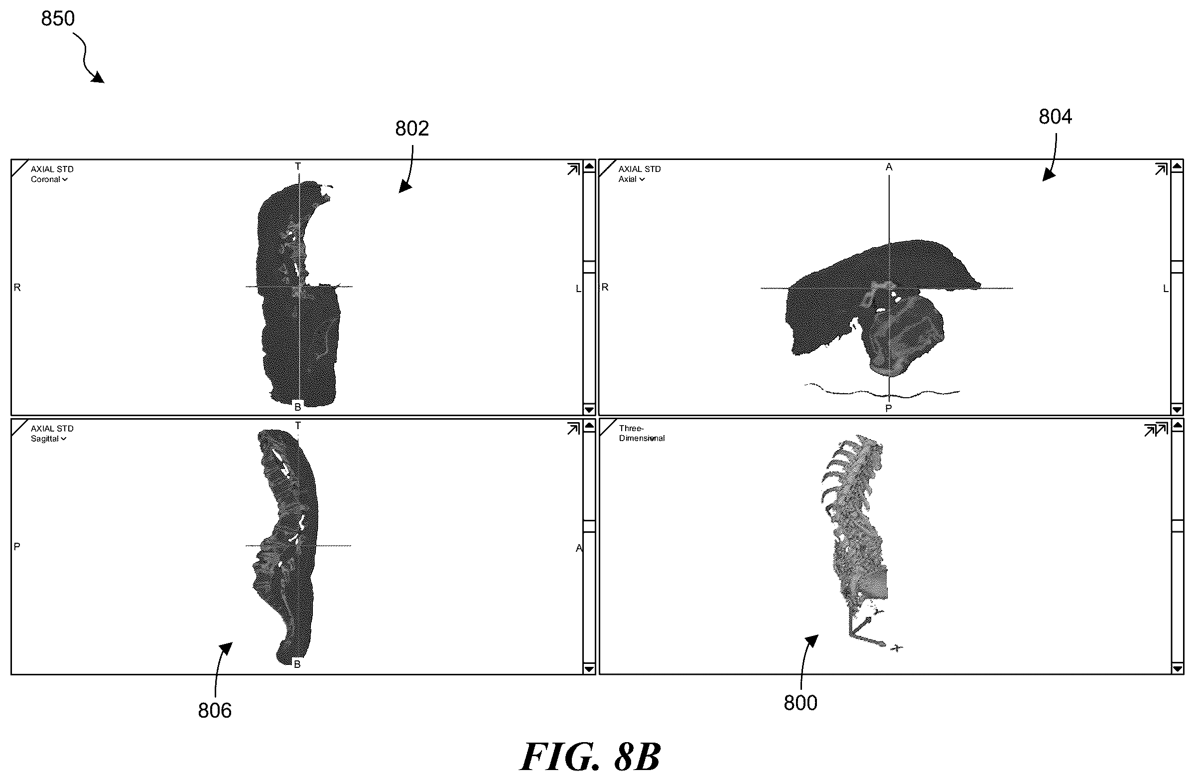 Patent US12376907 Figure 12 – Patient-specific medical systems, devices, and methods