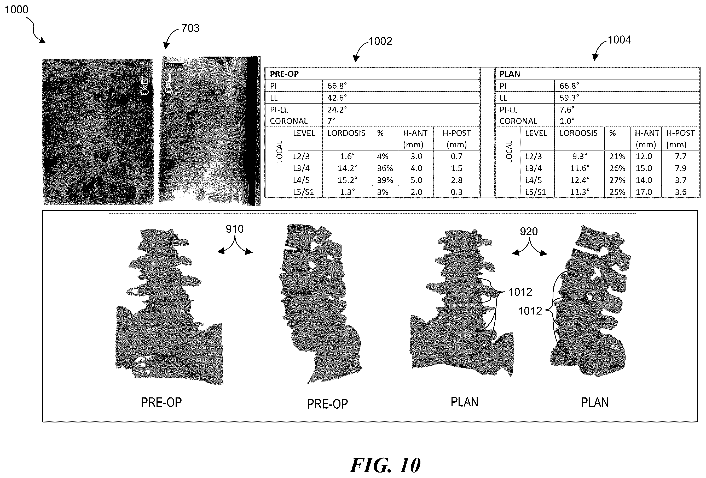 Patent US12376907 Figure 15 – Patient-specific medical systems, devices, and methods