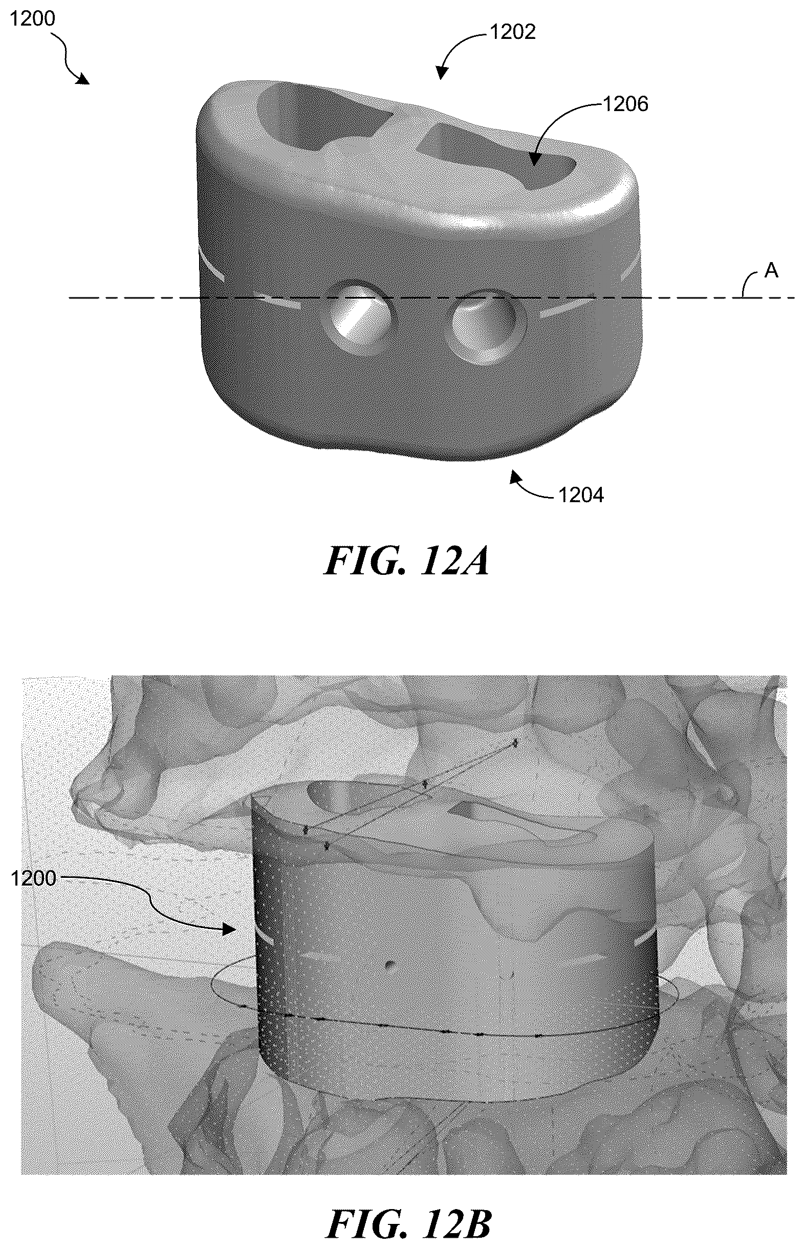 Patent US12376907 Figure 17 – Patient-specific medical systems, devices, and methods
