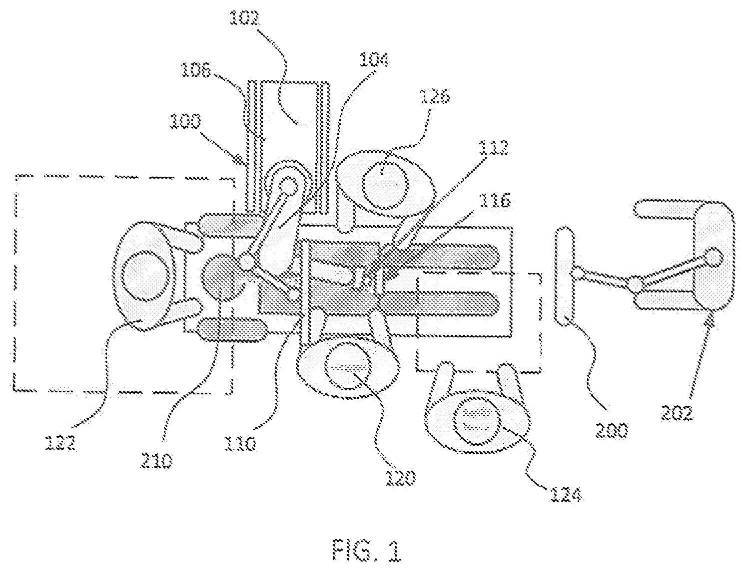 Patent US12376916 — System for a surveillance marker in robotic-assisted surgery — Figure 1