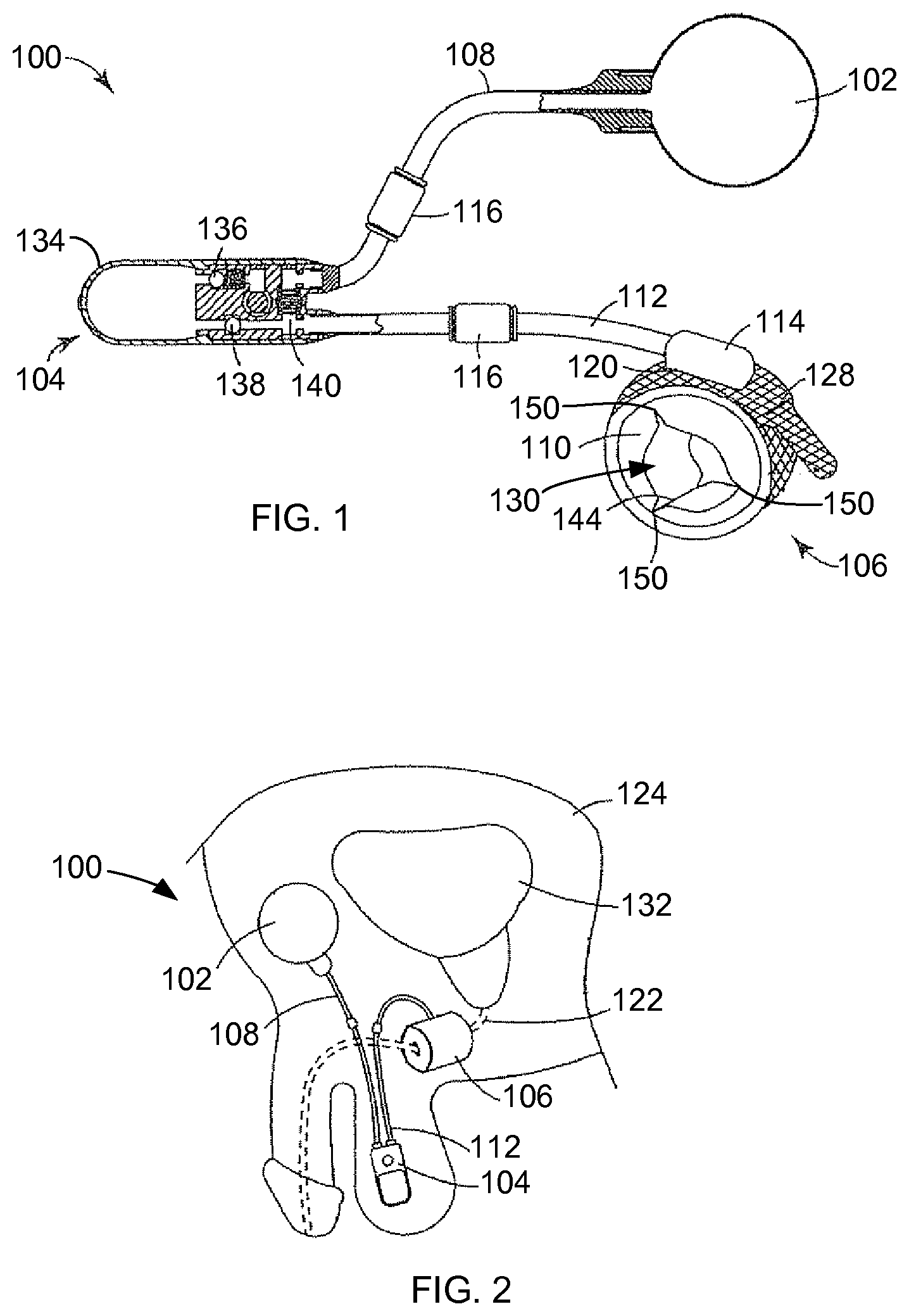 Patent US12376953 — Biased artificial sphincter cuff — Figure 1