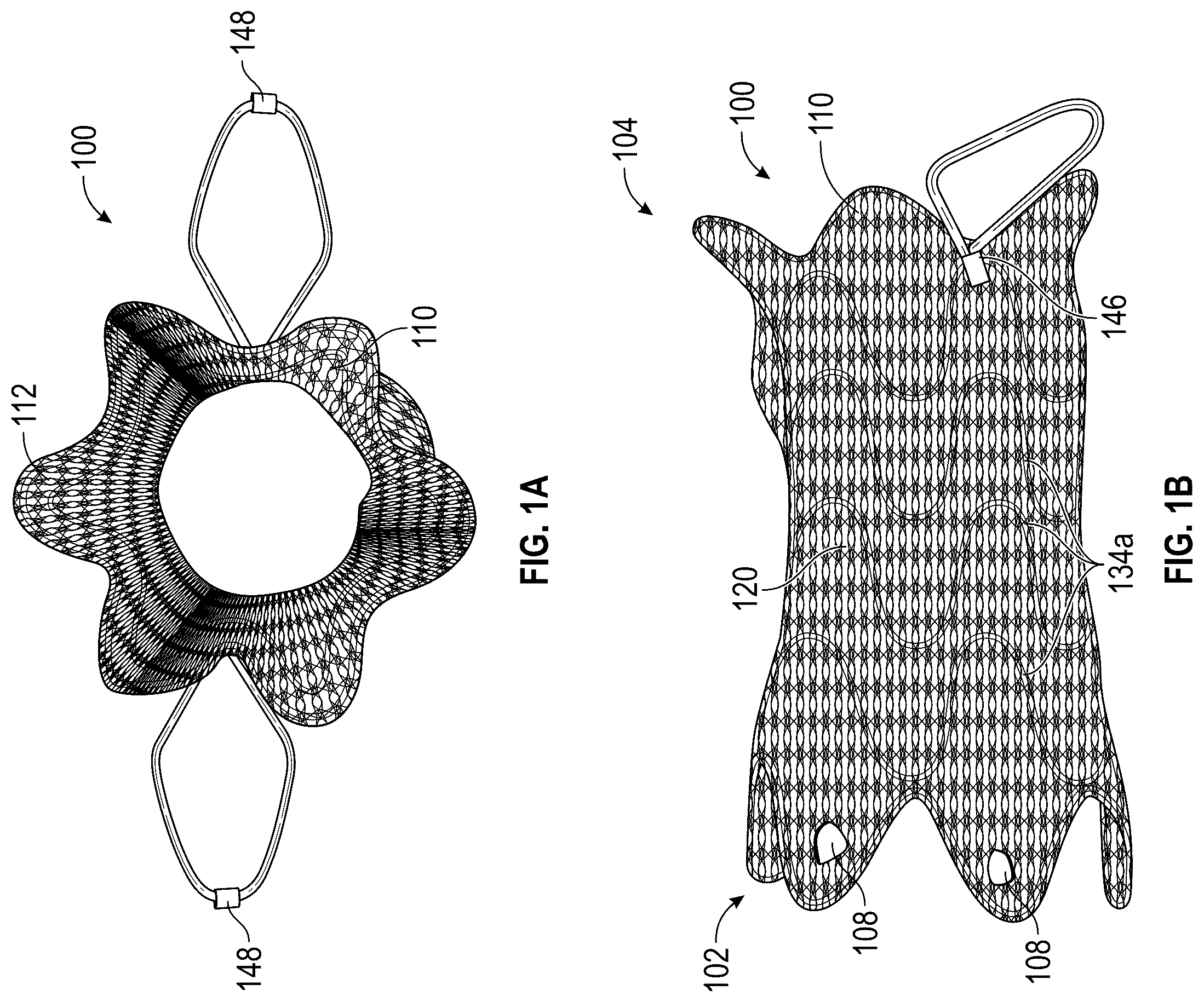 Patent US12376956 — Percutaneous shunt devices and related methods — Figure 1