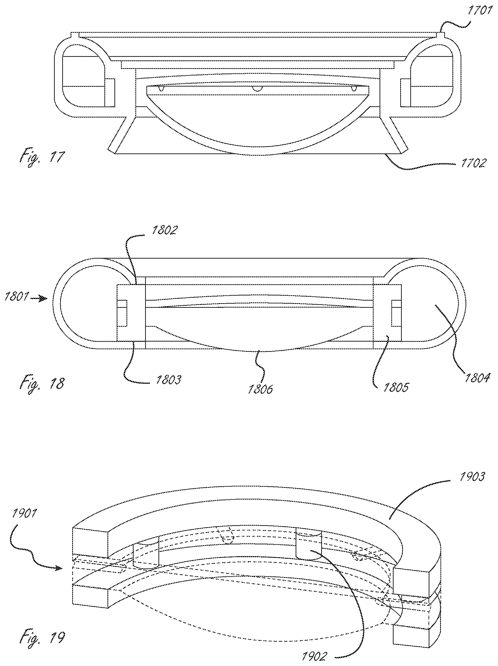 Patent US12376957 Figure 6 – Multi-piece accommodating intraocular lens