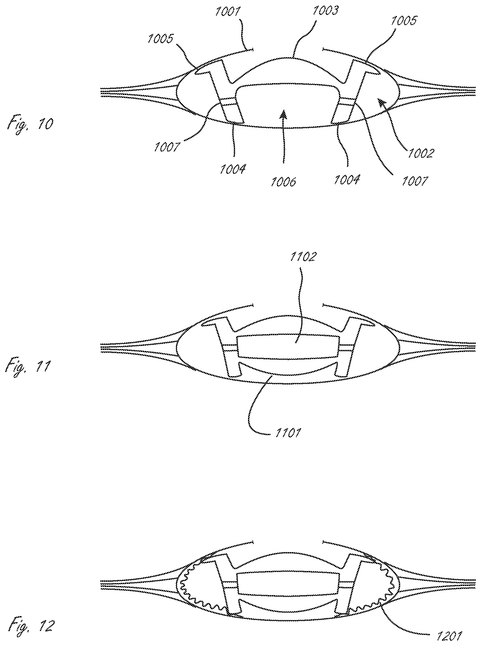 Patent US12376958 Figure 3 – Multi-piece accommodating intraocular lens