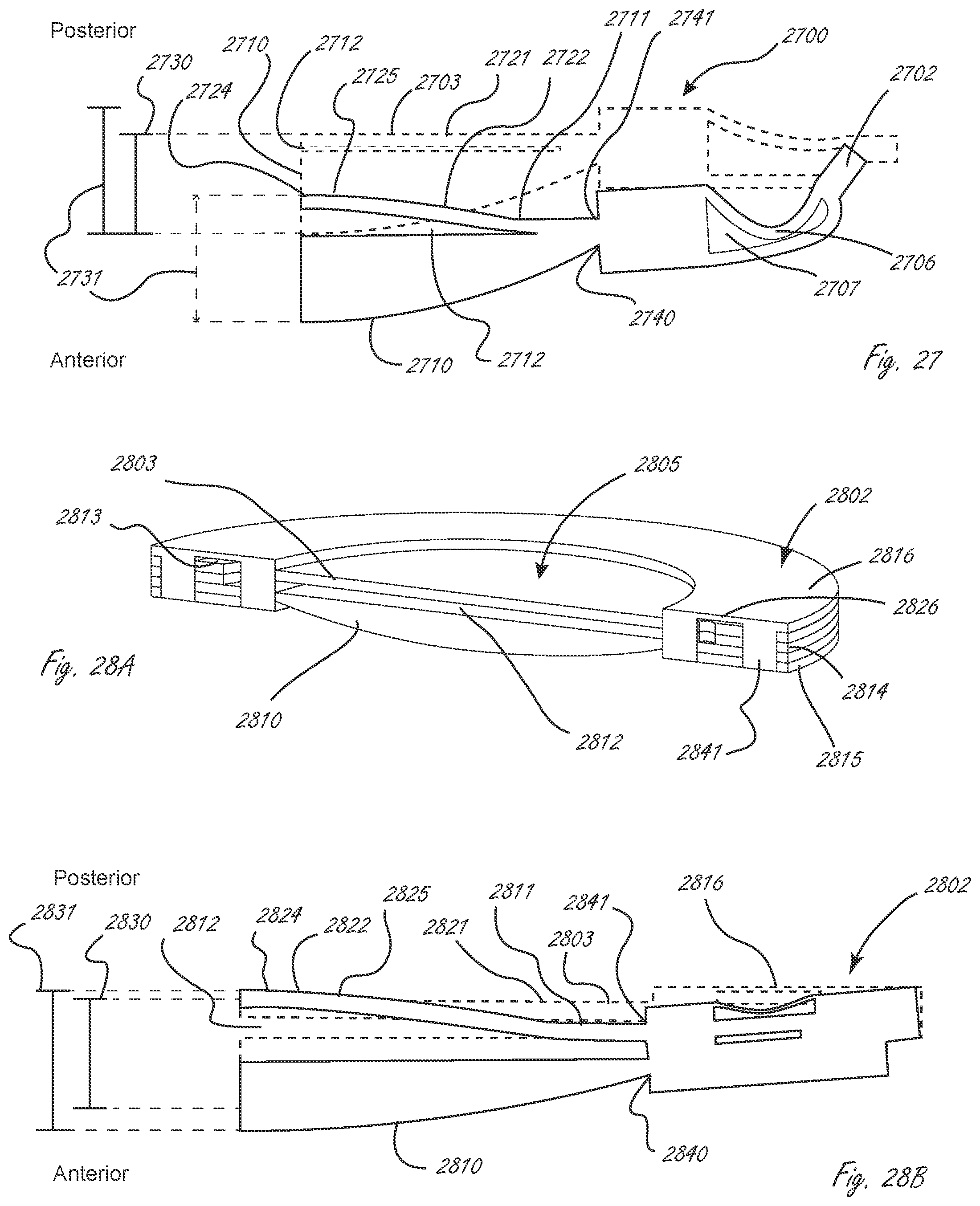 Patent US12376958 Figure 11 – Multi-piece accommodating intraocular lens