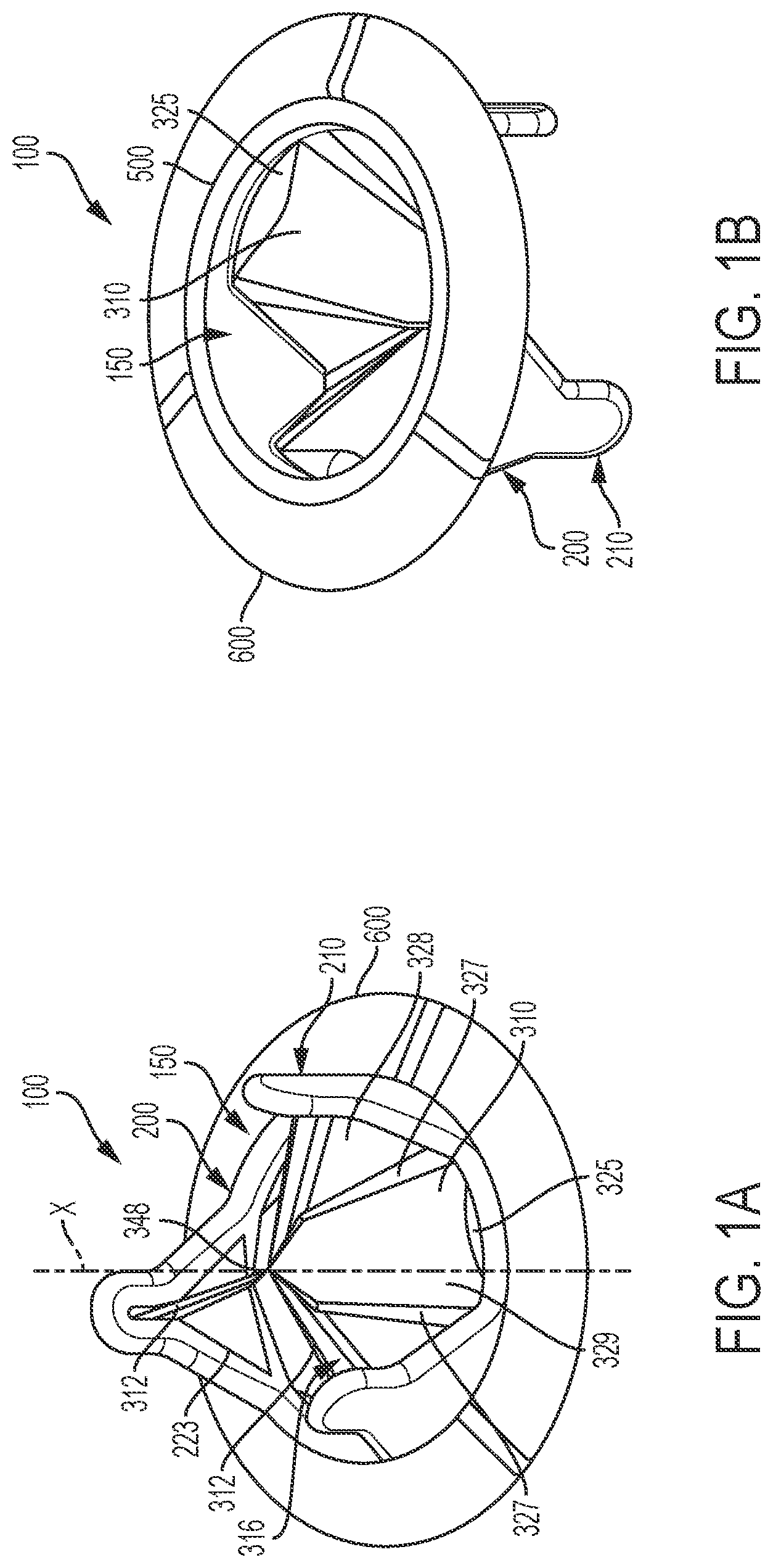 Patent US12376959 — Suture guard for a prosthetic valve — Figure 1