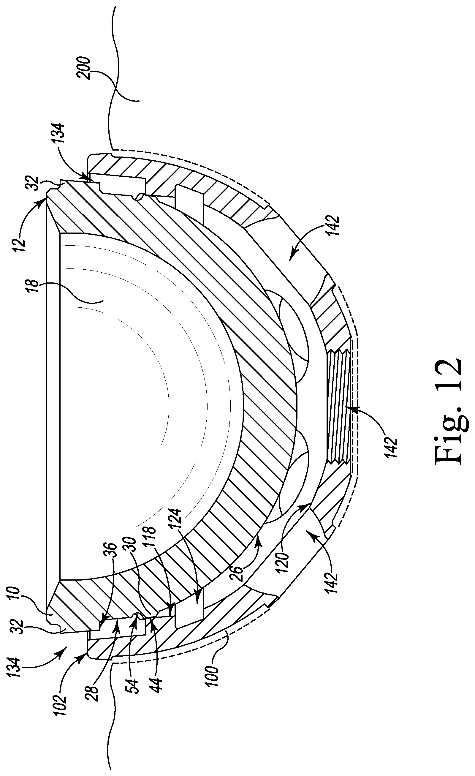 Patent US12376964 Figure 12 – Apparatus and method for locking an acetabular liner to an acetabular cup