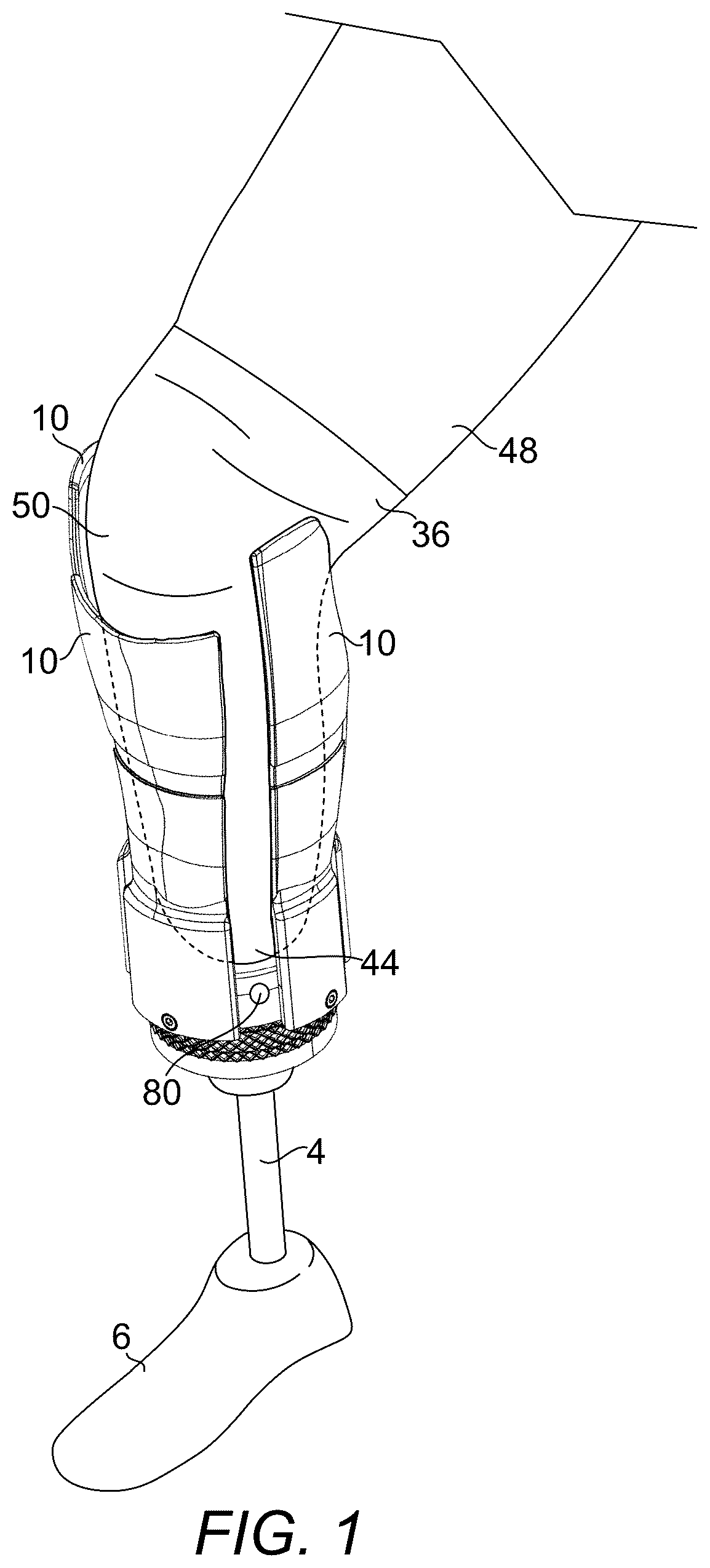 Patent US12376976 — Prosthetic socket — Figure 1