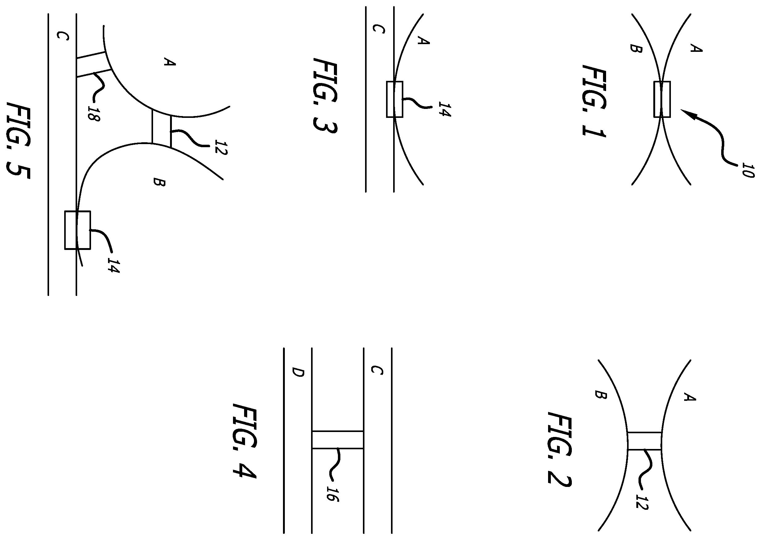 Patent US12376978 — Methods and technology for creating connections and shunts between vessels and chambers of biologic structures — Figure 1