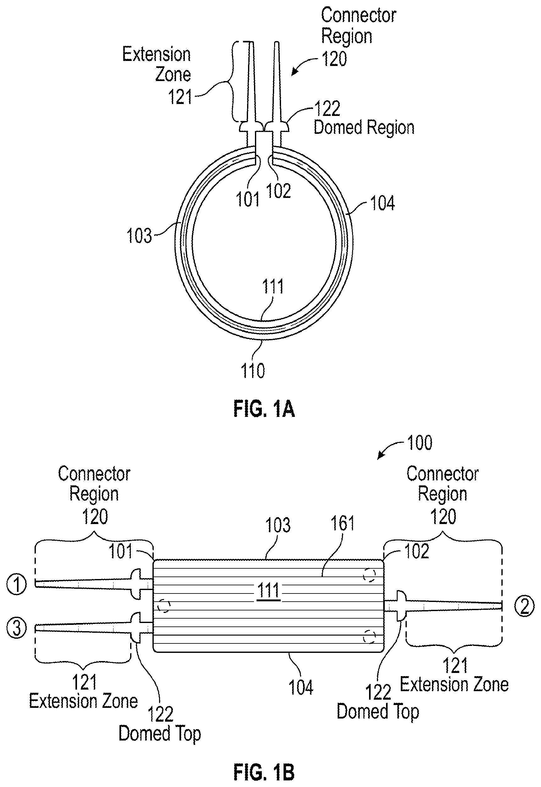 Patent US12376991 — Scleral buckle for alleviation of retinal detachment and refractive error — Figure 1