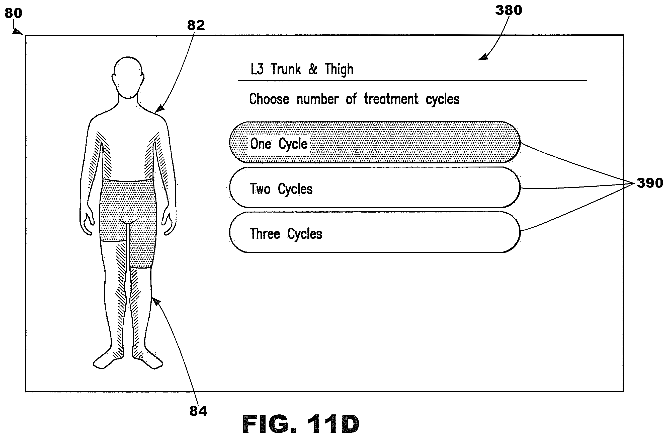 Patent US12377013 Figure 18 – Compression garment systems