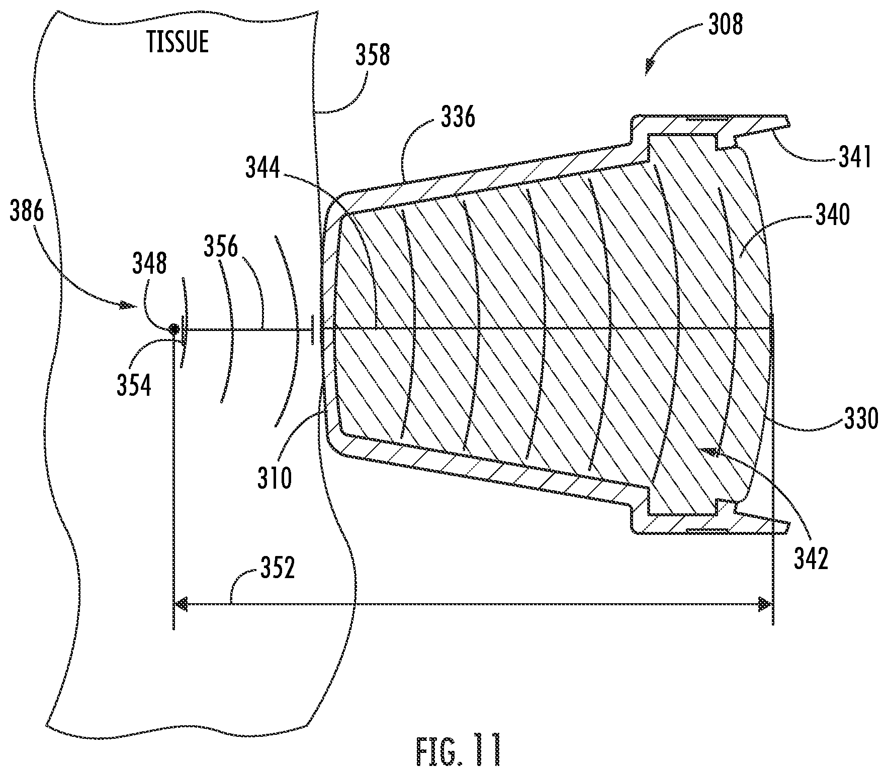 Patent US12377017 Figure 10 – Handheld focused extracorporeal shock wave therapy device, kit, and method