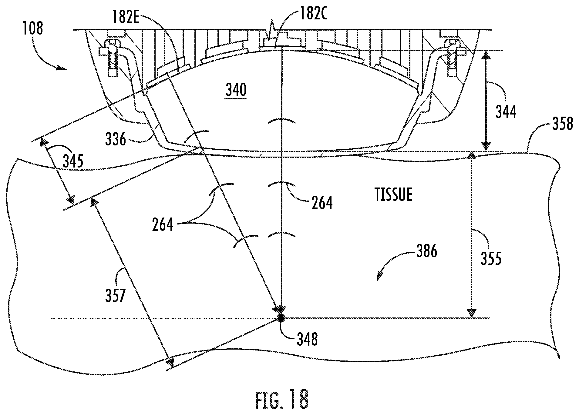 Patent US12377018 Figure 16 – Handheld focused extracorporeal shock wave therapy device, kit, and method