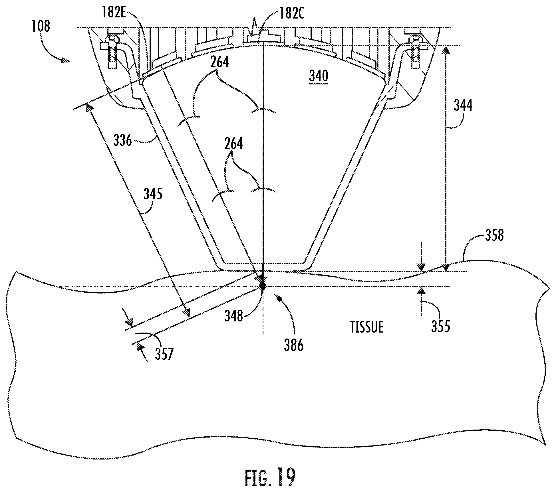 Patent US12377018 Figure 17 – Handheld focused extracorporeal shock wave therapy device, kit, and method