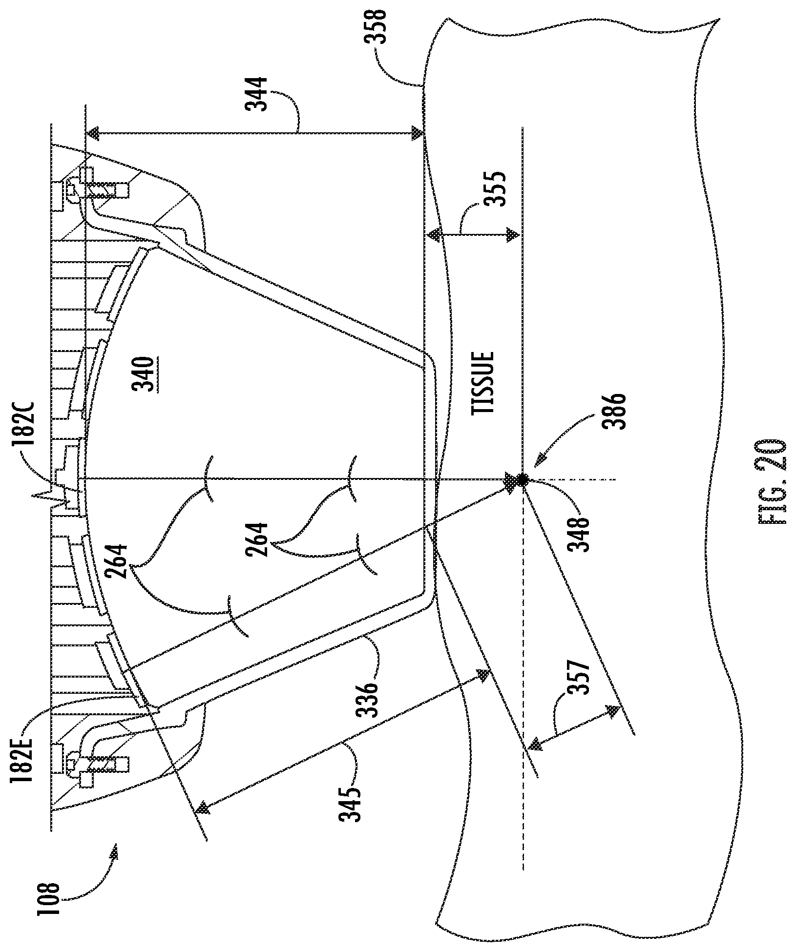 Patent US12377018 Figure 18 – Handheld focused extracorporeal shock wave therapy device, kit, and method