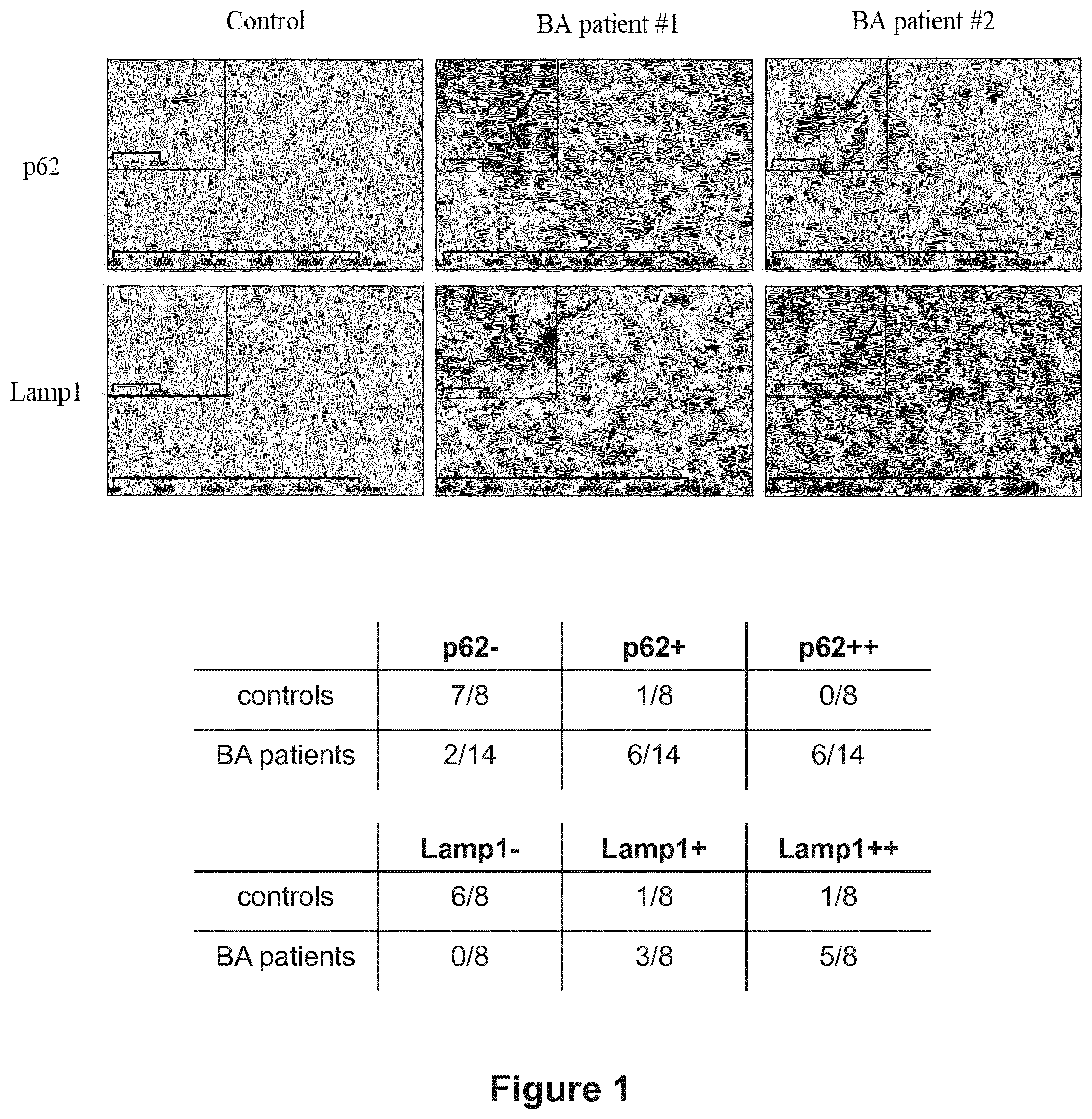 Patent US12377066 — Treatment of diseases associated with biliary system destruction — Figure 1