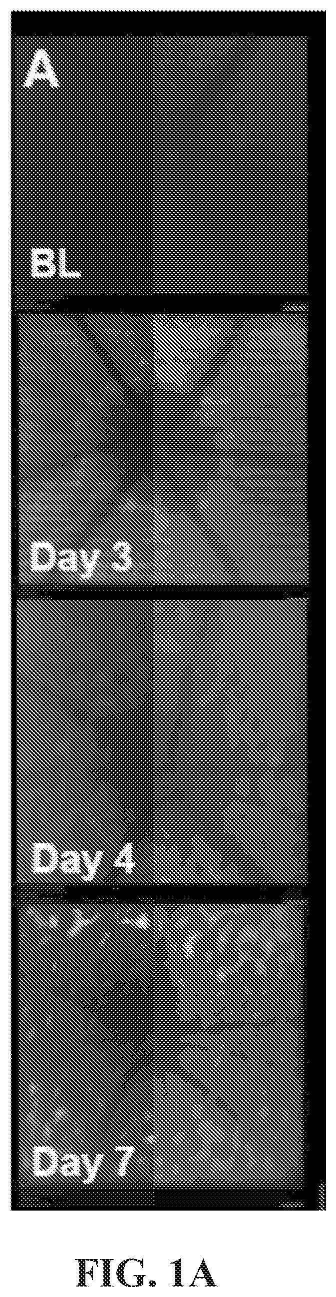 Patent US12377171 Figure 1 – Methods for treating and diagnosing blinding eye diseases