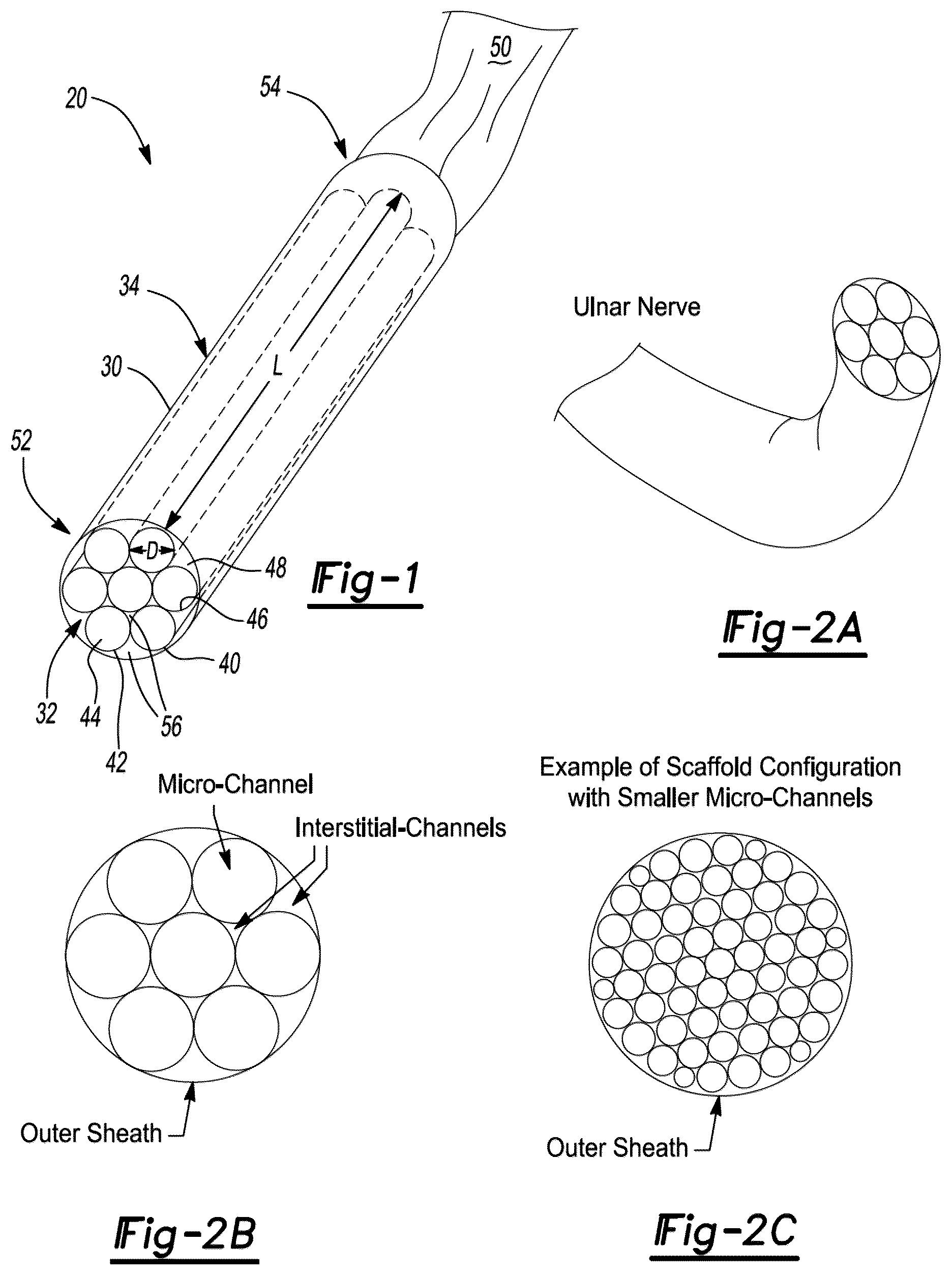 Patent US12377195 — Nerve repair scaffolds having high microchannel volume and methods for making the same — Figure 1