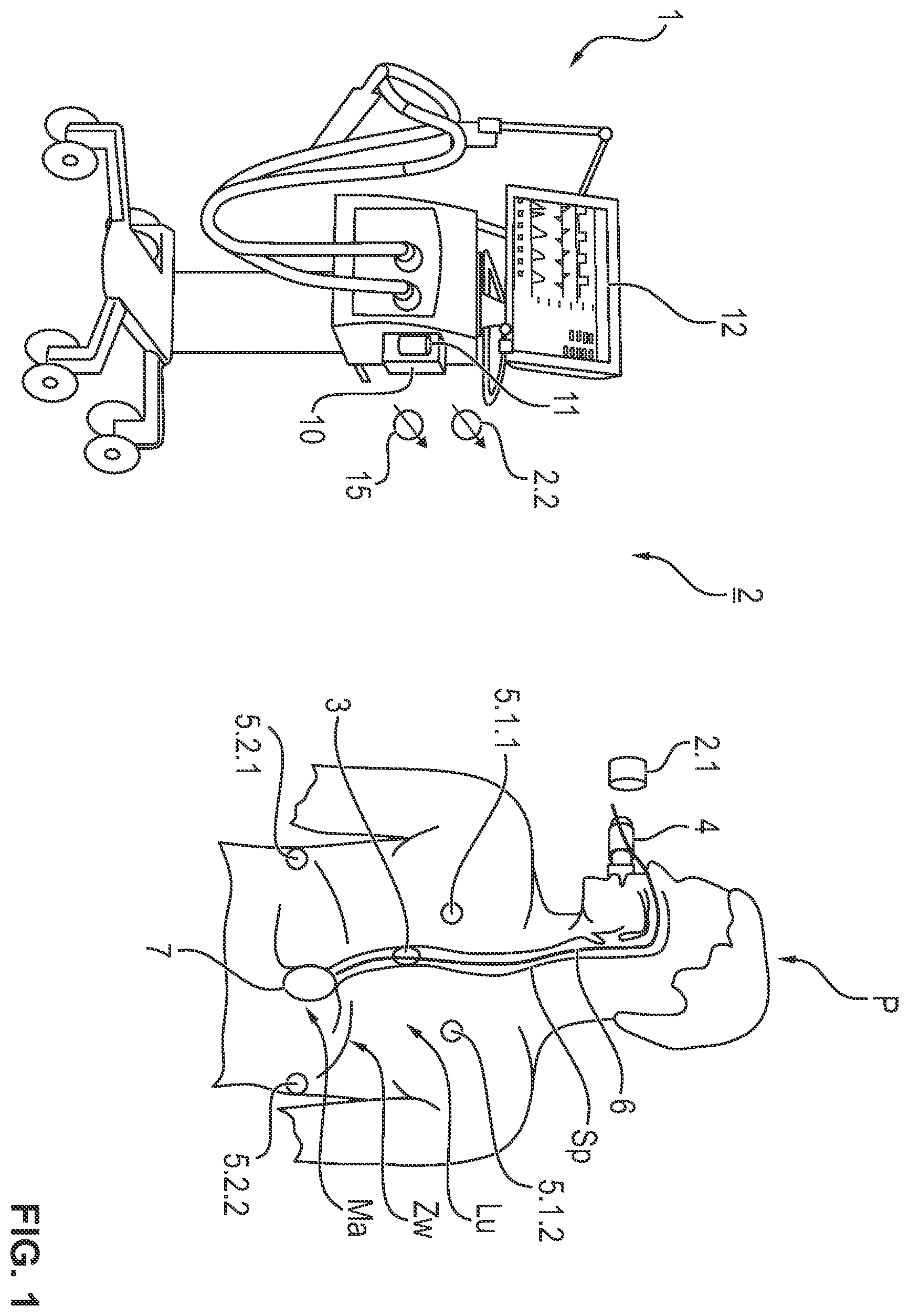 Patent US12377233 — Process and devices for automatically specifying the frequency set point of a ventilator — Figure 1