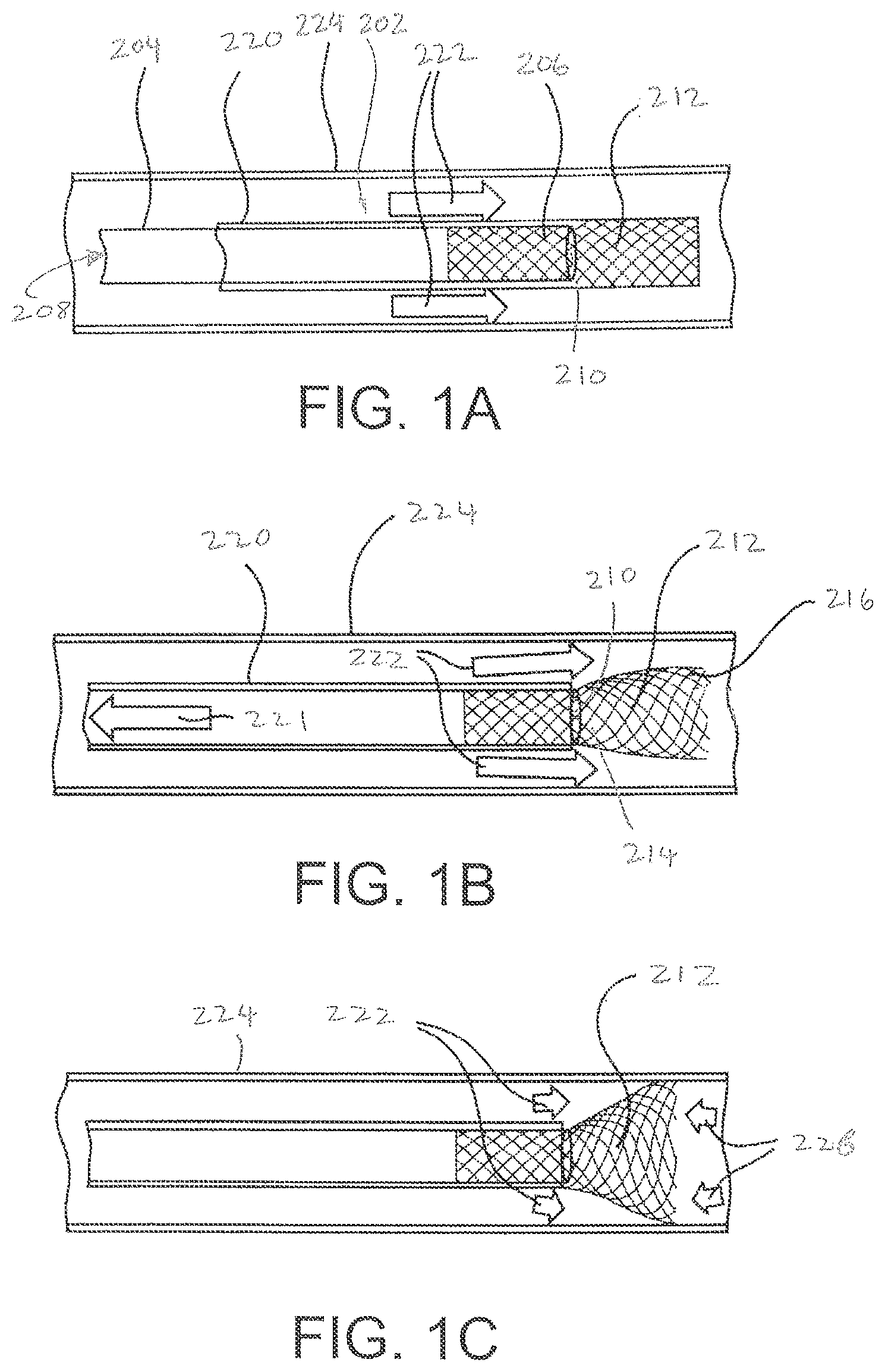 Patent US12377245 — Method of delivering a therapeutic agent to a solid tumor for treatment — Figure 1