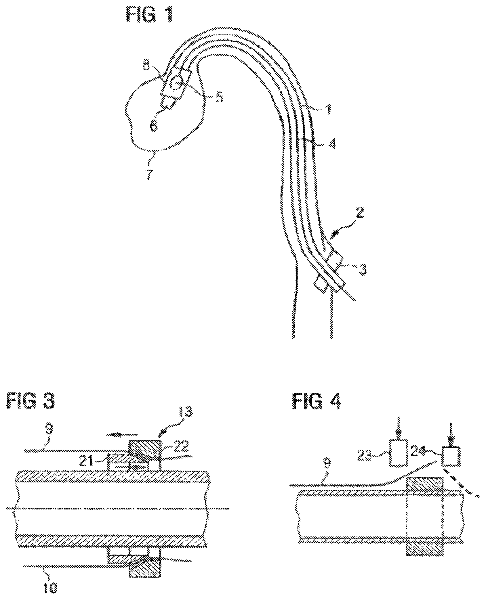 Patent US12377246 — Catheter device having a catheter and an actuation device — Figure 1