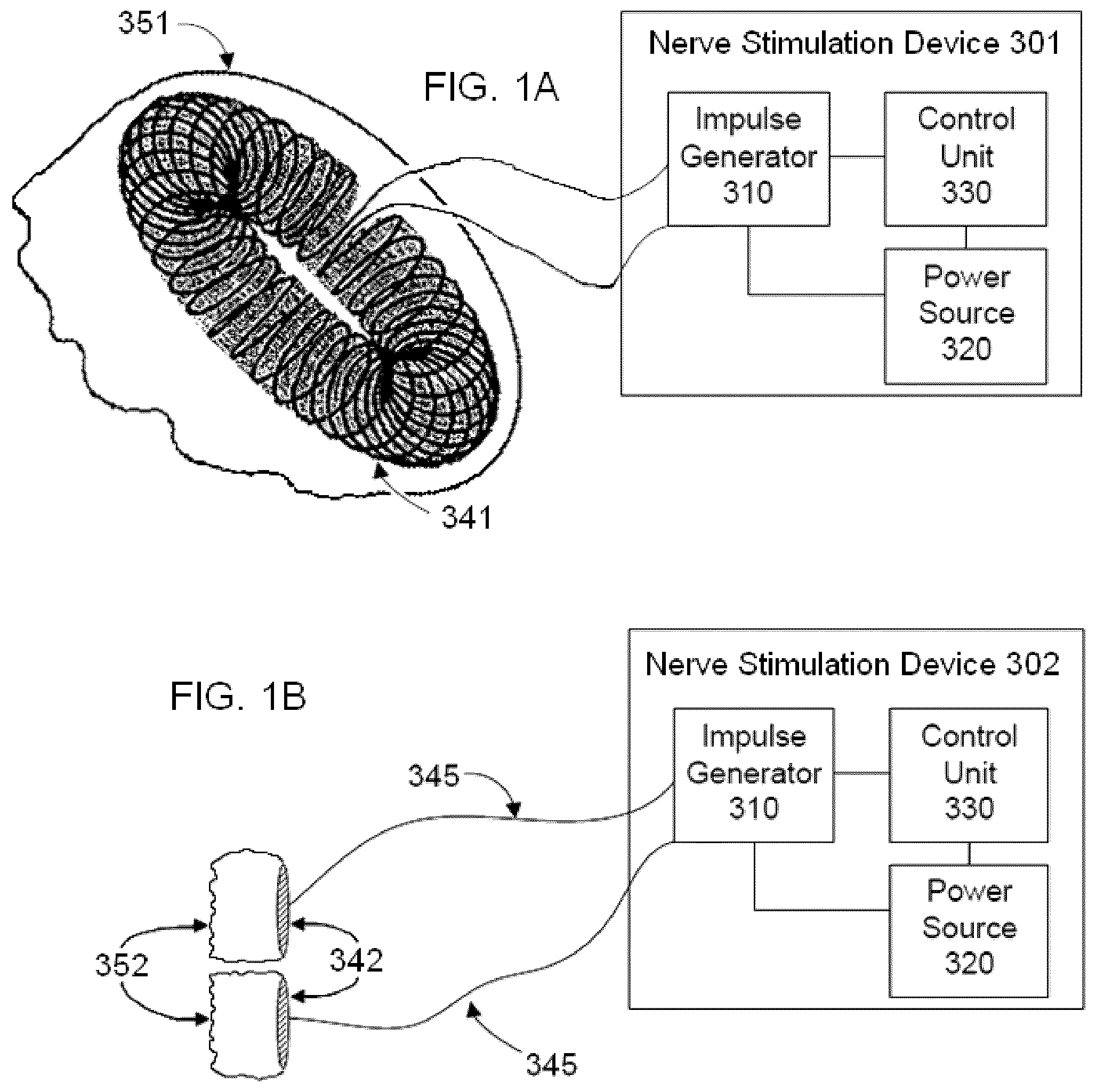 Patent US12377260 Figure 1 – Vagal nerve stimulation