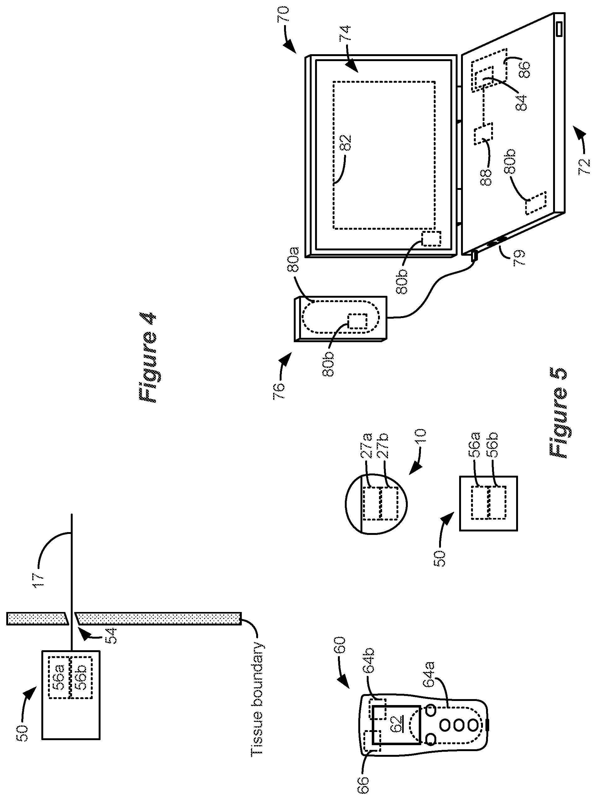 Patent US12377274 Figure 3 – Interpolation methods for neural responses