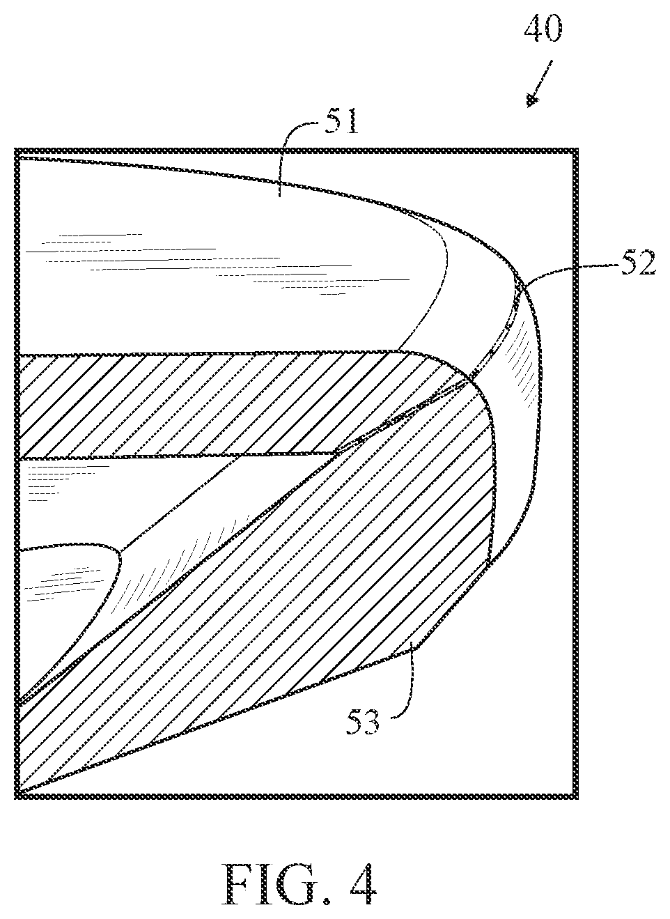 Patent US12377323 Figure 4 – Golf club head with miter joint for brazing