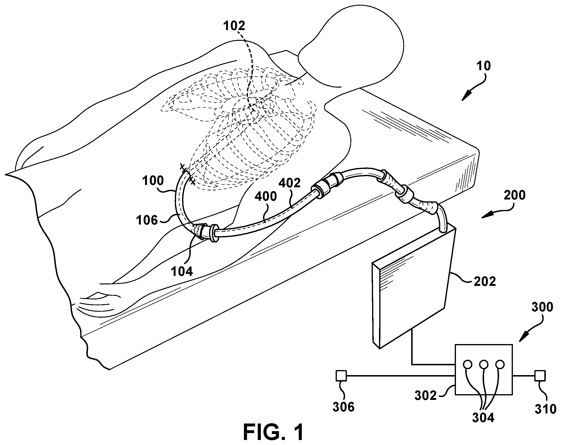 Patent US12378094 — Devices and methods related to medical tubes — Figure 1