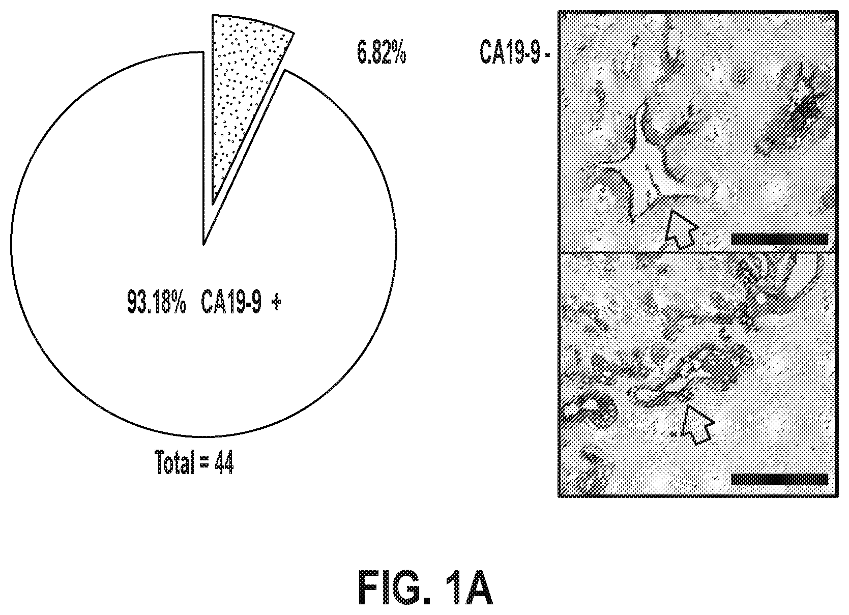 Patent US12378320 — Methods for treating pancreatitis — Figure 1