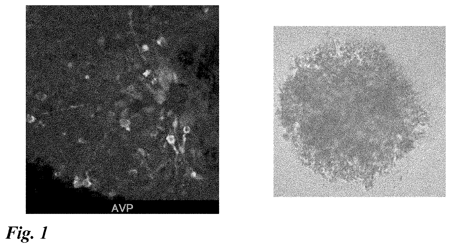 Patent US12378518 Figure 1 – Differentiation induction from human pluripotent stem cells into hypothalamic neurons