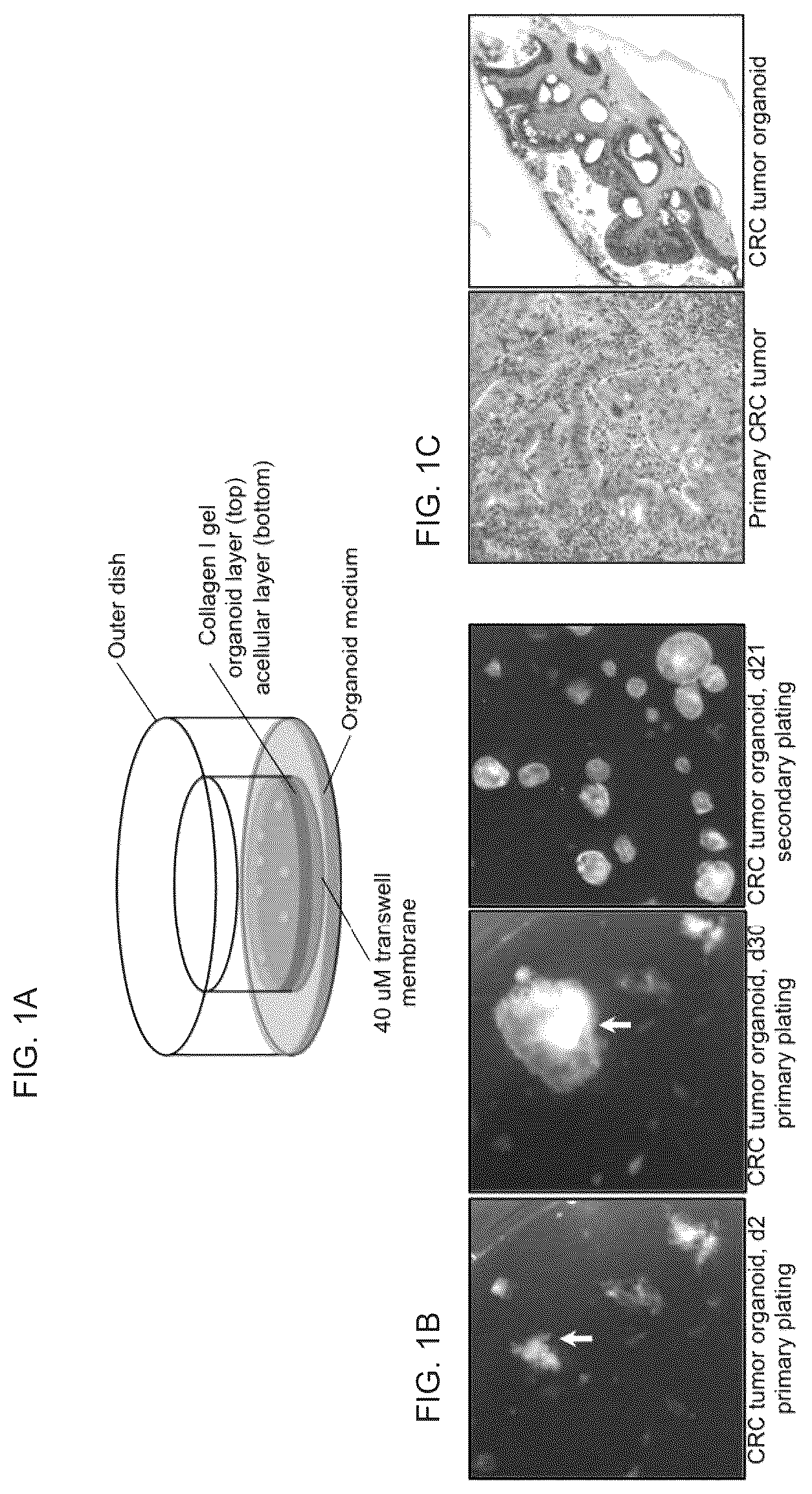 Patent US12378530 — Methods to preserve tumor-stromal interactions in culture and therapeutic predictive applications thereof — Figure 1