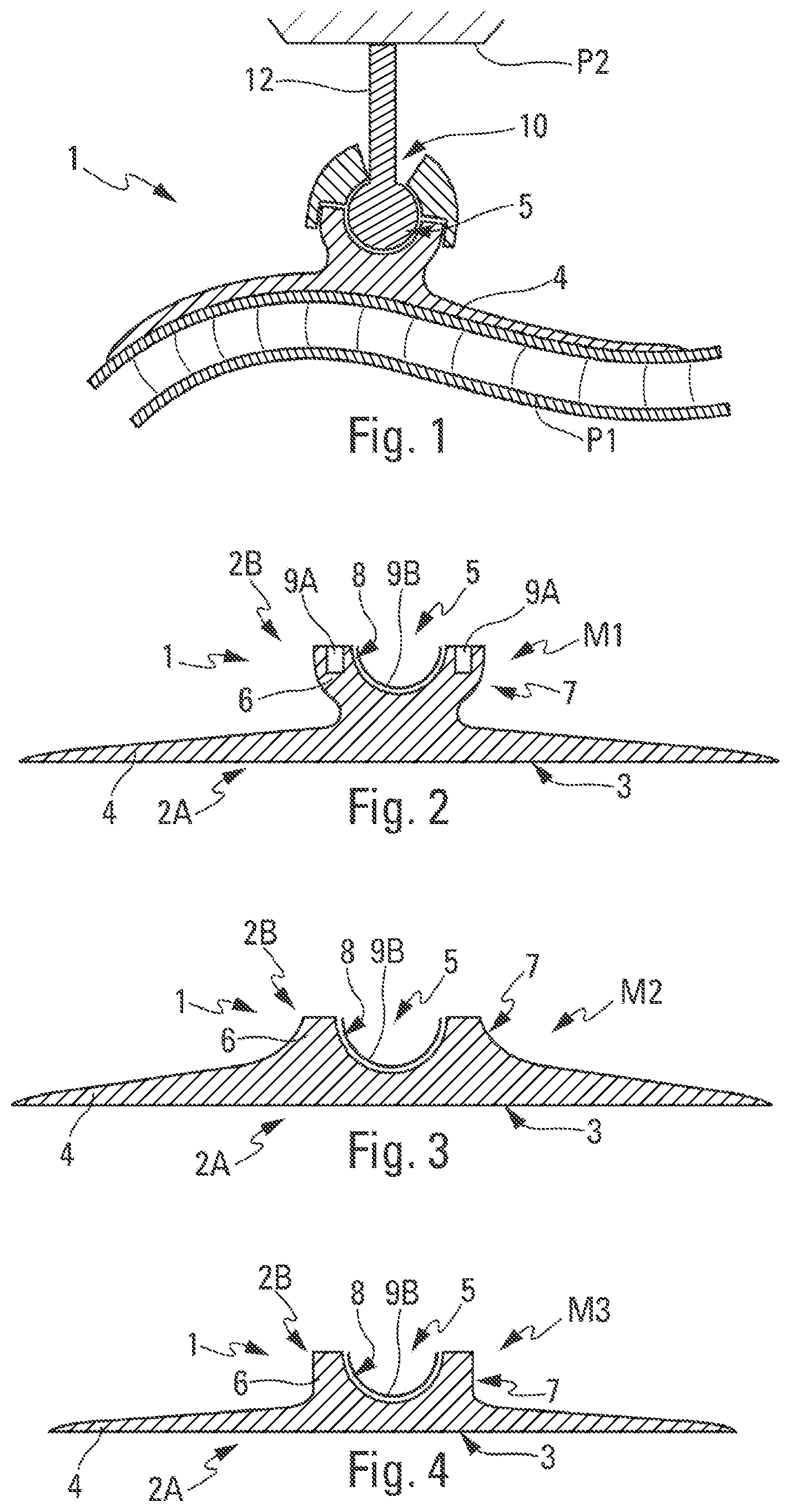 Patent US12378989 — Partially polymerised thermohardenable connection part and methods for producing and assembling such a connection part — Figure 1
