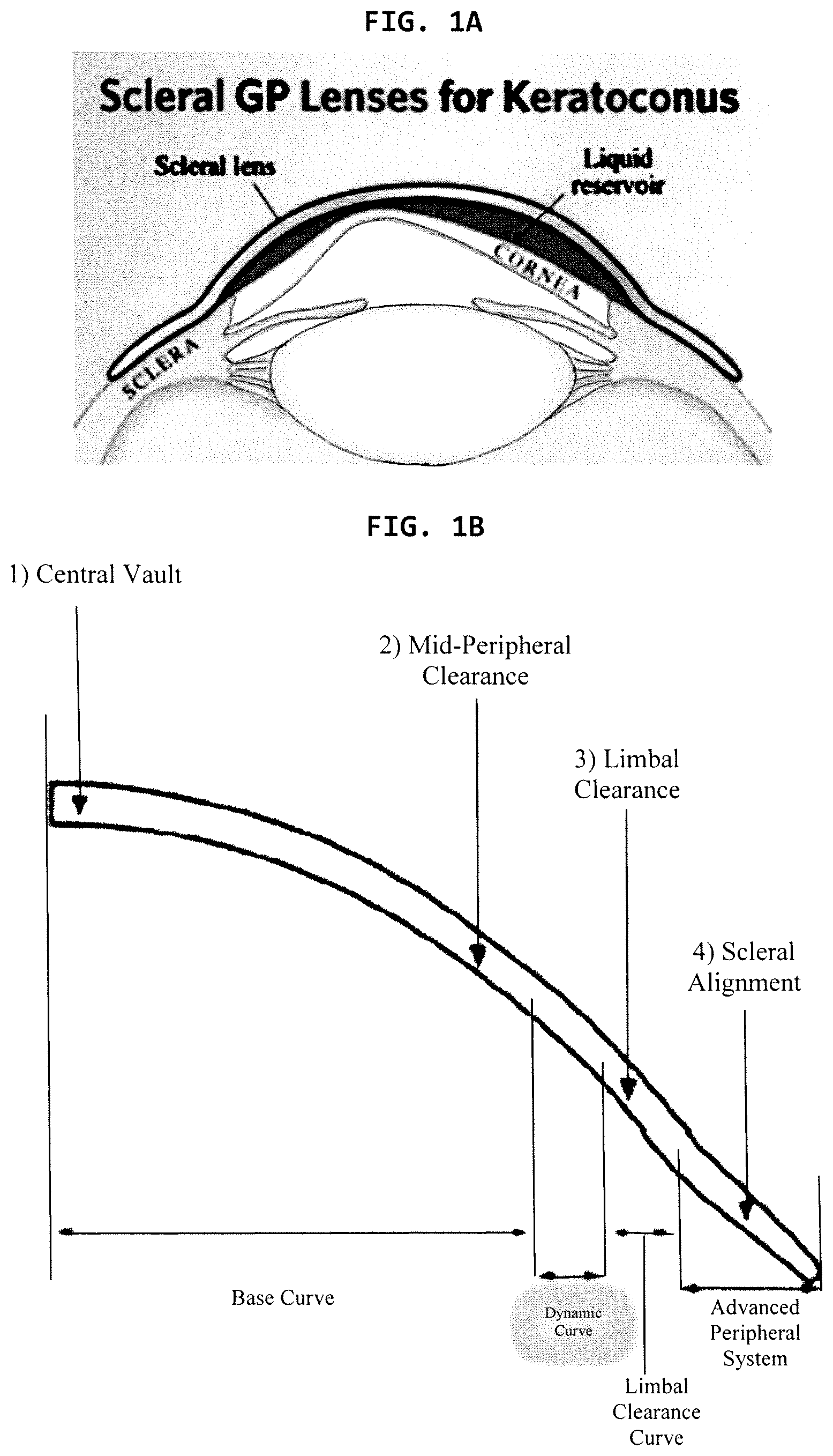 Patent US12386200 Figure 1 – Method for obtaining contact lenses with dynamically controlled sagitta and clearance