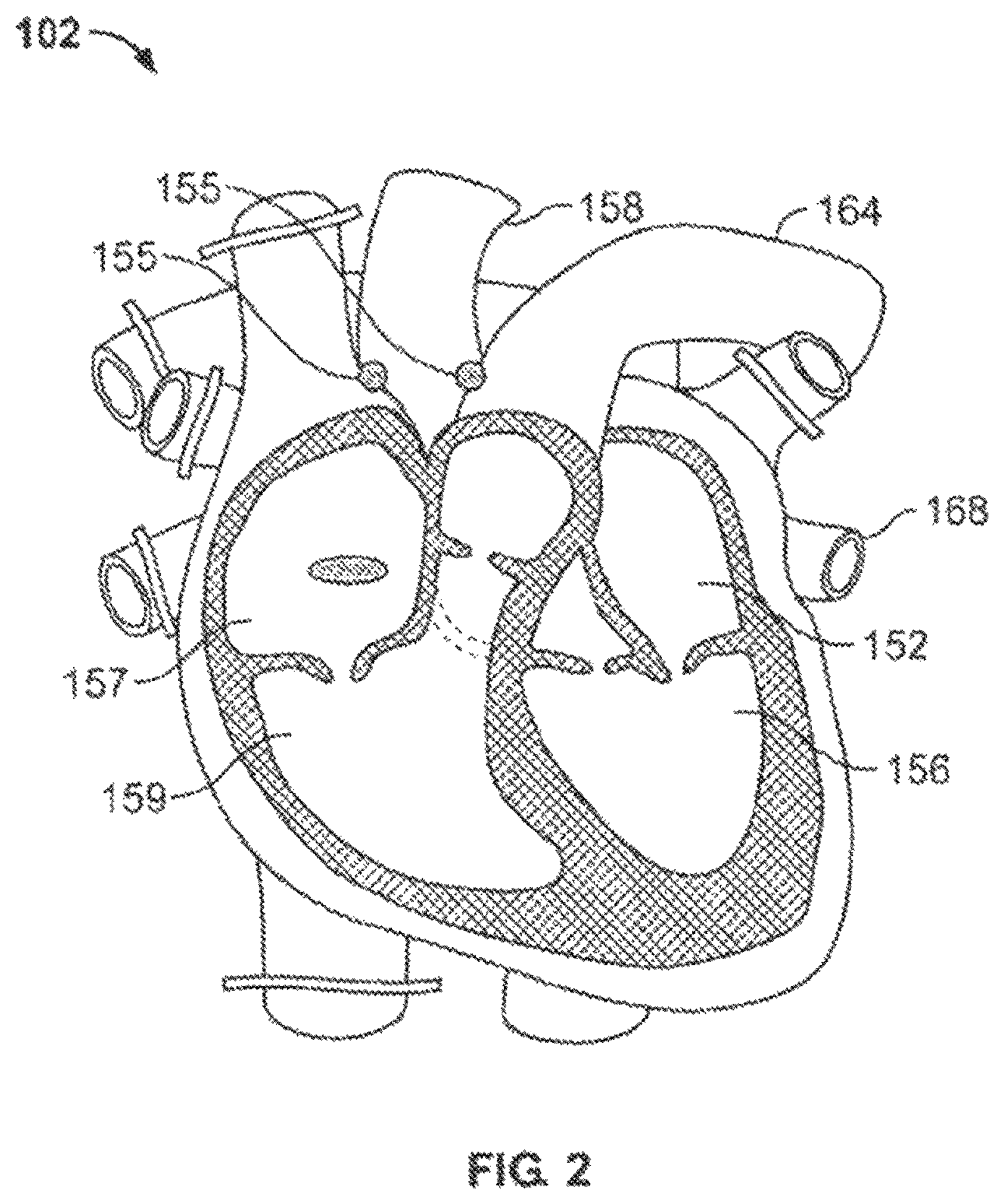 Patent US12396454 Figure 2 – Systems and methods for ex-vivo organ care and for using lactate as an indication of donor organ status