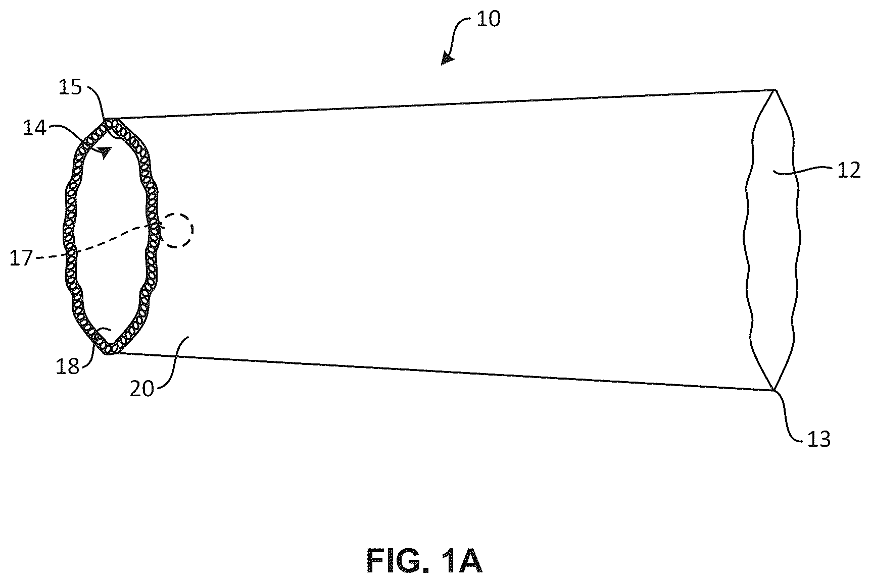 Patent US12396500 — Fluid management system, apparatus for making fluid management system and method of manufacturing fluid management system — Figure 1