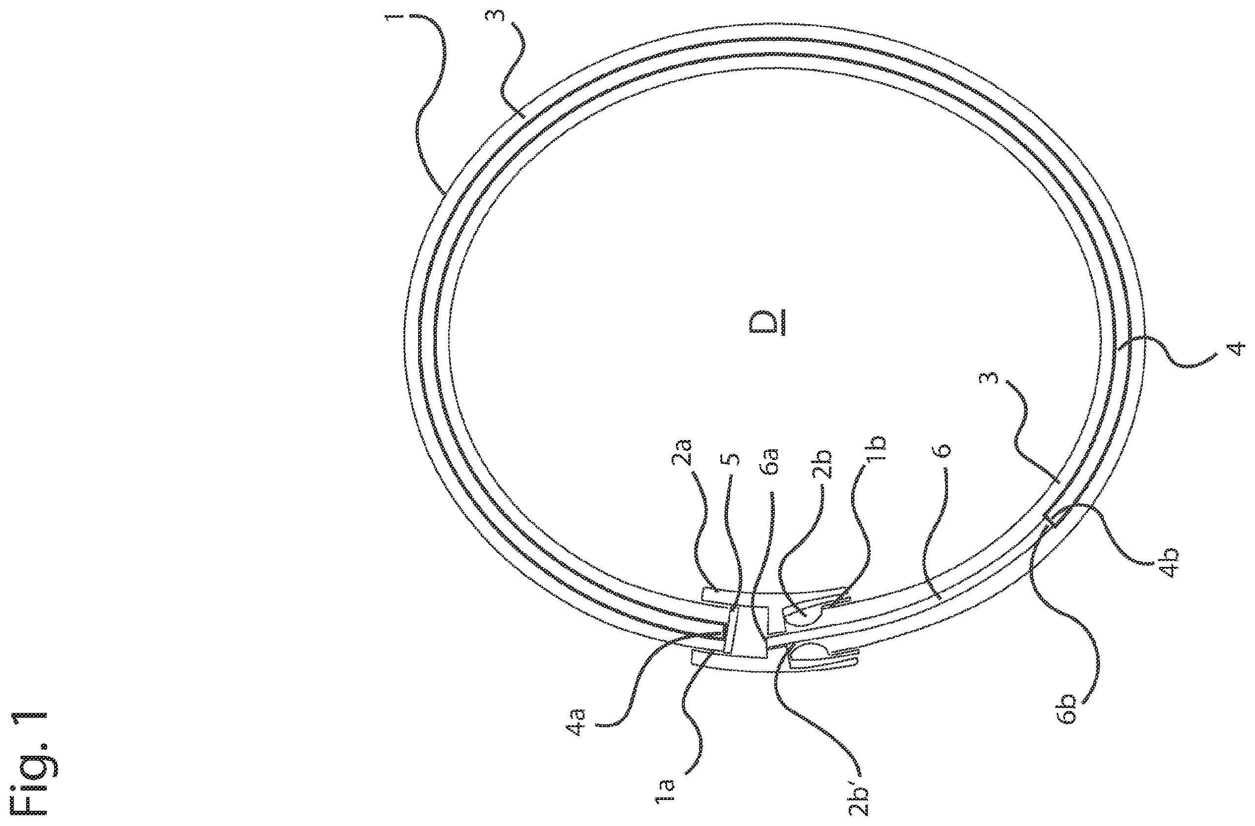 Patent US12396527 — Jewelry piece — Figure 1