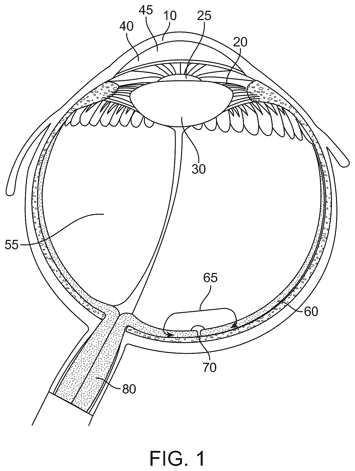 Patent US12396639 Figure 1 – Miniaturized mobile, low cost optical coherence tomography system for home based ophthalmic applications